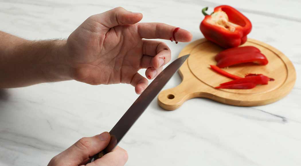 Saiba o que acontece quando um participante do MasterChef corta o dedo (Foto: iStock)